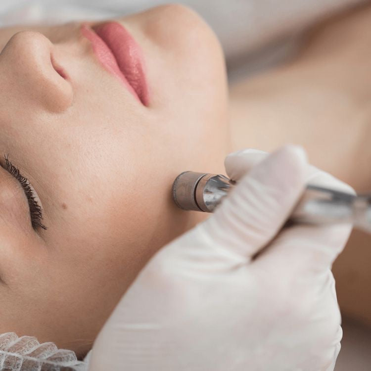 MICRODERMABRASION