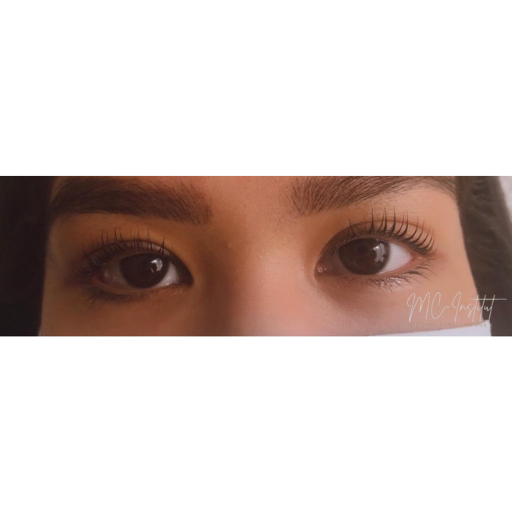 REHAUSSEMENT DE CILS