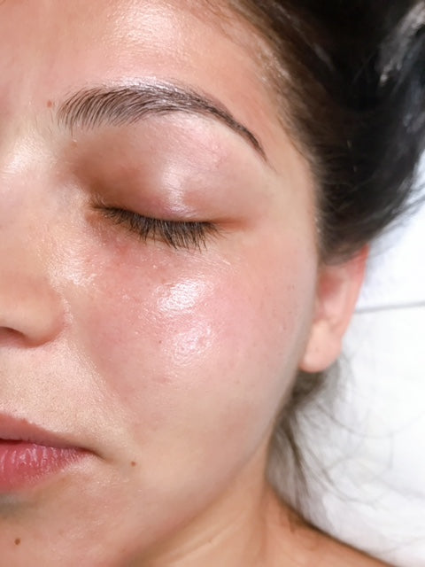 Beauté du visage