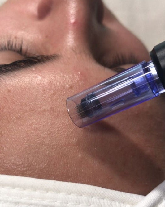 MICRONEEDLING - Soin anti-âge & éclat